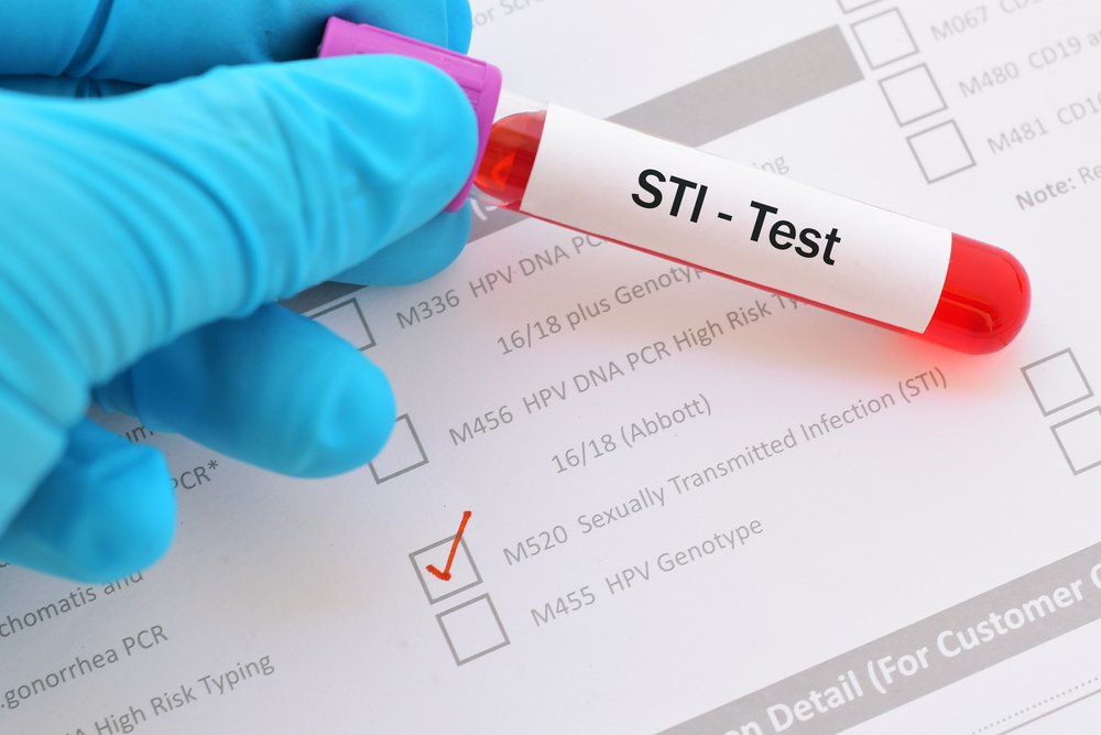 Getting Tested For Stis